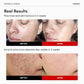 BestBy12/26 FRANKLY Retinol 0.1% Cream 1.01oz Night Anti-Aging Korean Skin Care